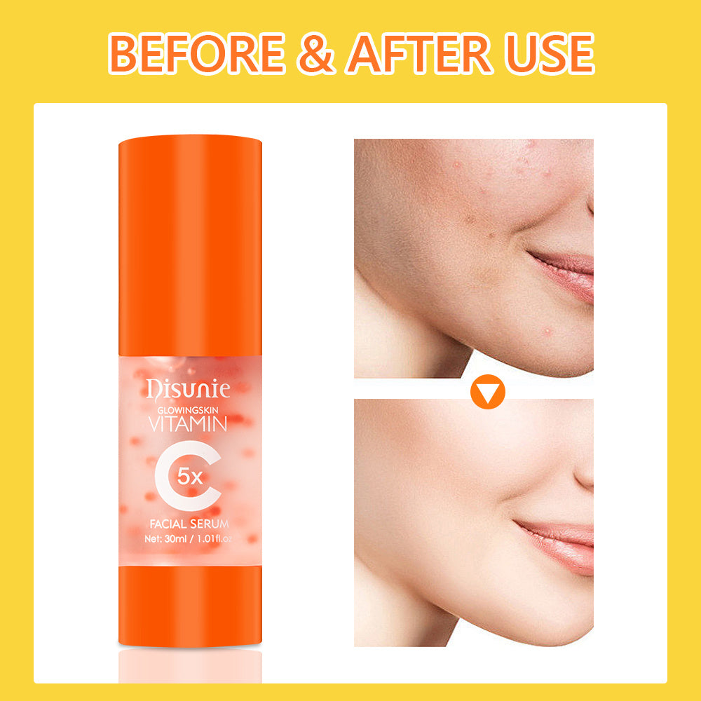 Vit C Face Serum Facial Whitening