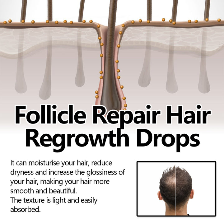 Anti-fall Strong Hair Fixing Serums