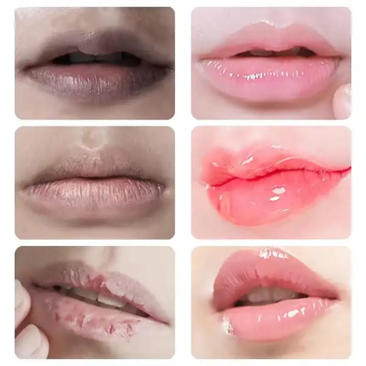 Remove Dark Lip Balm Fast Lightening Pink