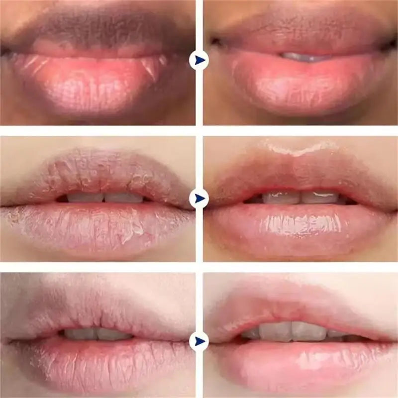 Remove Dark Lip Balm Fast Lightening Pink