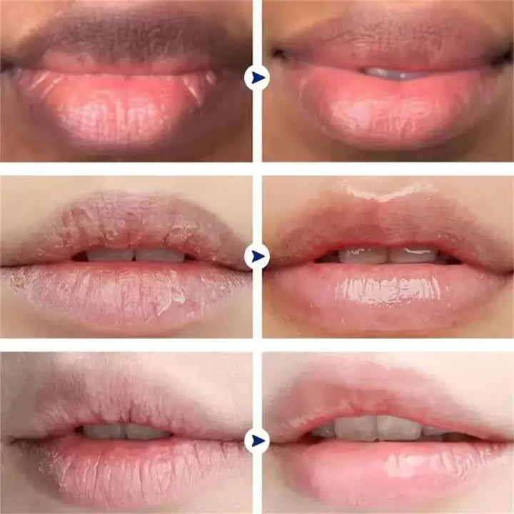 Remove Dark Lip Balm Fast Lightening Pink