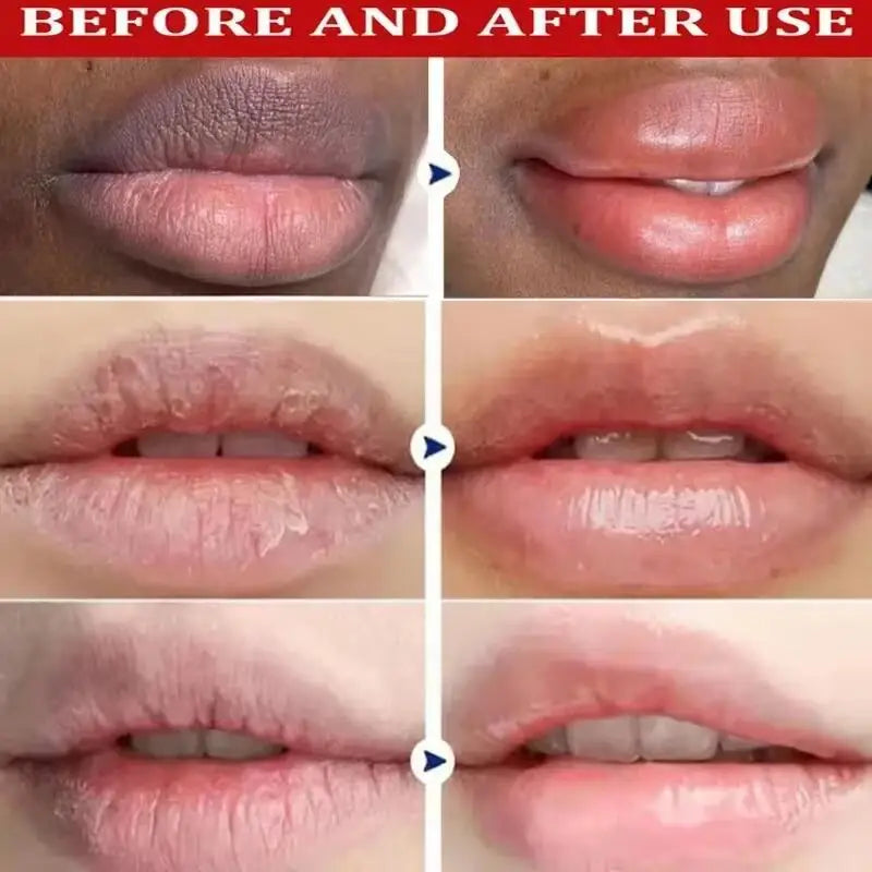 Remove Dark Lip Balm Fast Lightening Pink