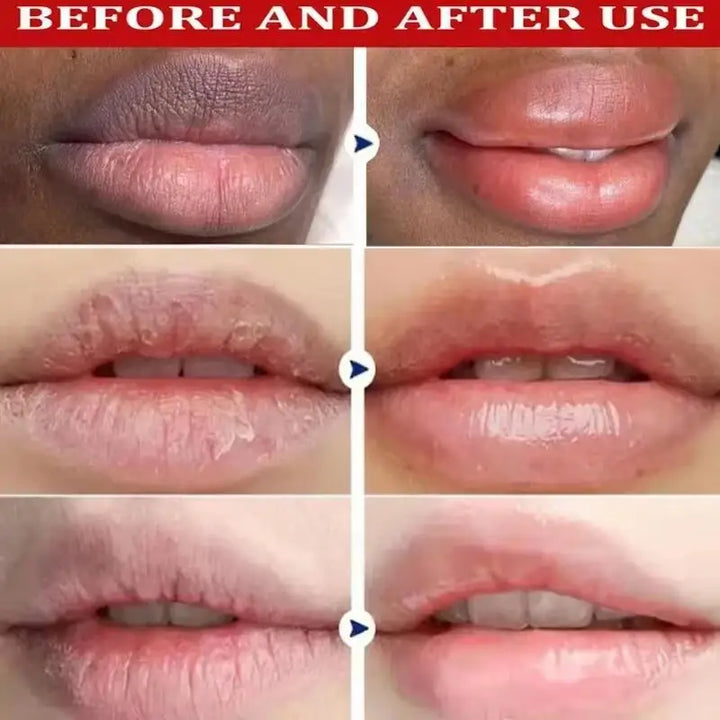 Remove Dark Lip Balm Fast Lightening Pink