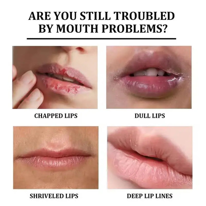 Remove Dark Lip Balm Fast Lightening Pink