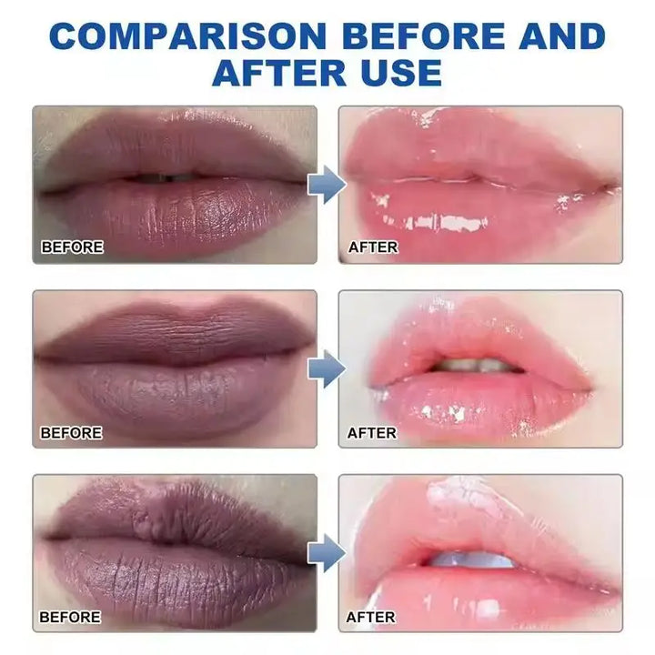 Remove Dark Lip Balm Fast Lightening Pink