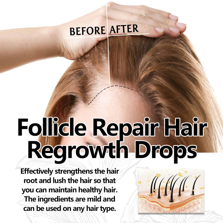 Anti-fall Strong Hair Fixing Serums