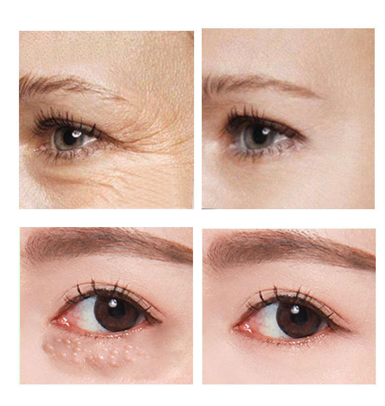 Beauty Eye Cream 30ml